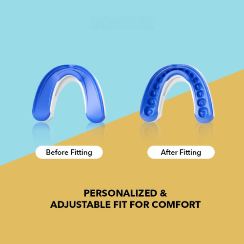 SilentEase™ Anti-Snore Mouthpiece
