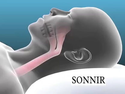 SilentEase™ Anti-Snore Mouthpiece